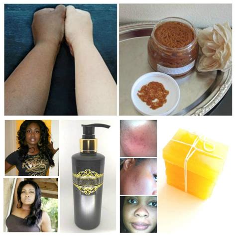 Drop Ten Years From Your Age With These Skin Care Tips Skin bleaching