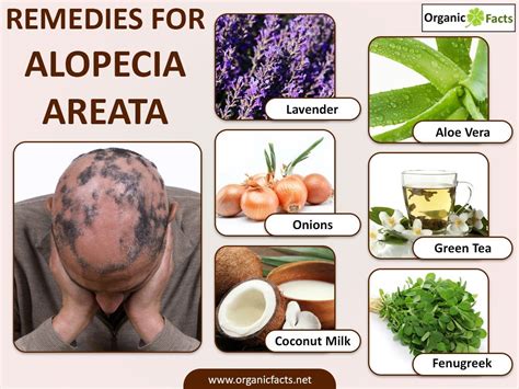 natural supplements for alopecia areata