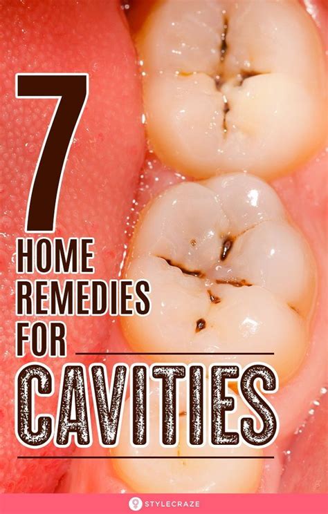 natural ways to help cavities