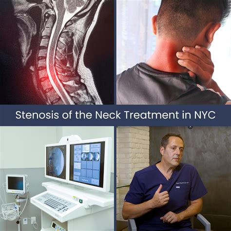 neck arthritis specialists new york