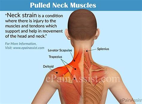 Understanding and Managing a Neck Muscle Tear: Causes, Symptoms, and Effective Treatments
