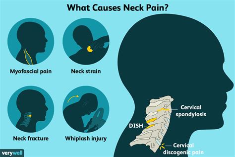 neck pain and stiffness on one side