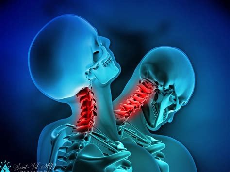 neck pain from old whiplash injury