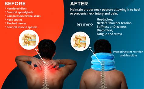 neck pain treatments at home