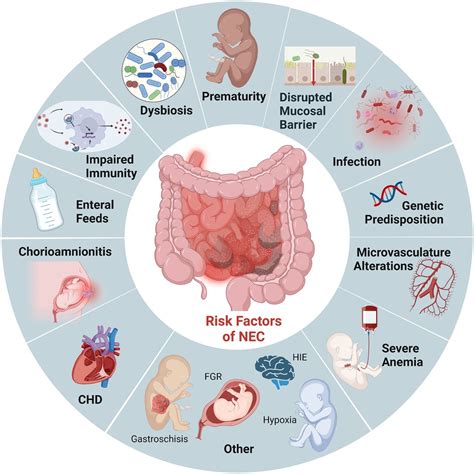 Understanding Necrotizing Enterocolitis NEC: Causes and Treatment Options