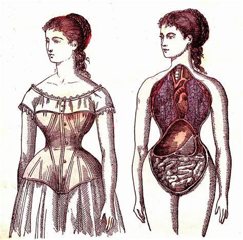 Negative Effects Of Corsets