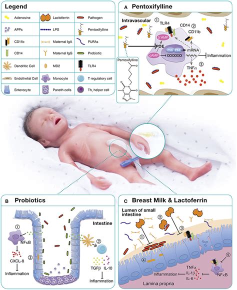 neonatal sepsis pdf