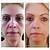 nerium before and after pictures - picturemeta ead