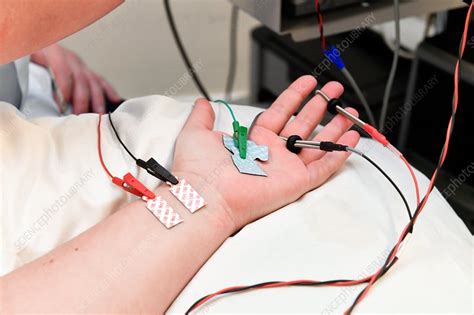 Understanding Nerve Conduction Tests: What to Expect and Why They're Done