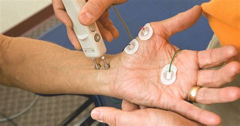 Understanding Nerve Health: What to Expect from a Nerve Test EMG