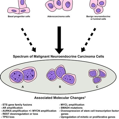 neuroendocrine malignancy