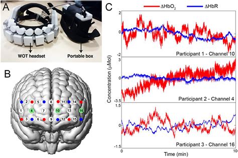 Neurotypical Meaning Explained