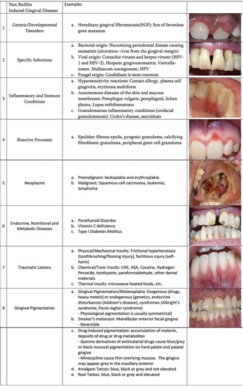 New Perio Classification Examples