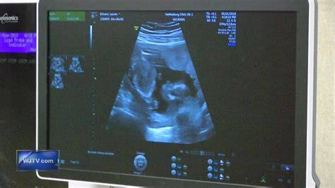 10 Myths About New Sonogram Technology Debunked