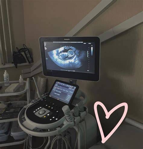10 Myths About New Sonogram Technology Debunked
