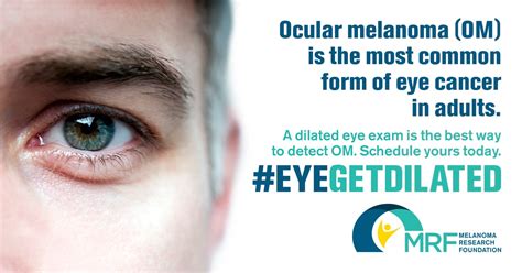 new treatment for ocular melanoma