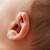 newborn ear color determine skin color