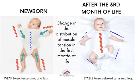 Newborn Arm Not Moving