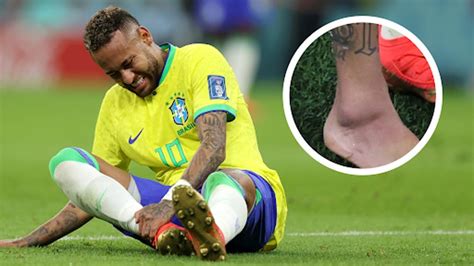 neymar ankle injury photos