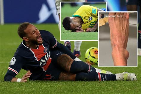neymar injury today