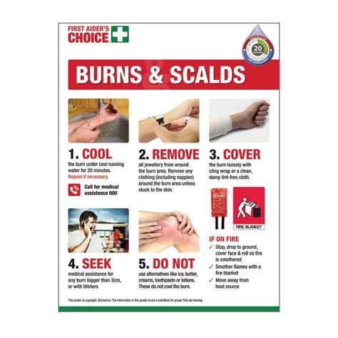 nhs burns and scalds