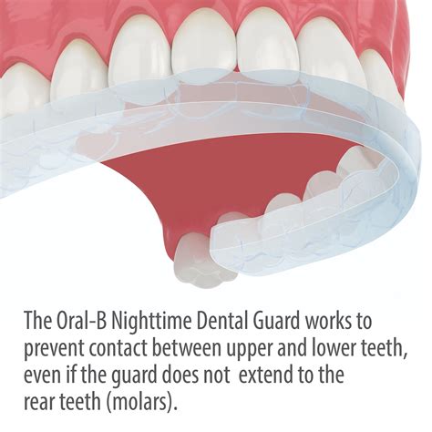 Night Guard Dental Code: Essential Guide for Optimal Protection
