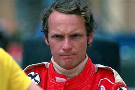 niki lauda before and after