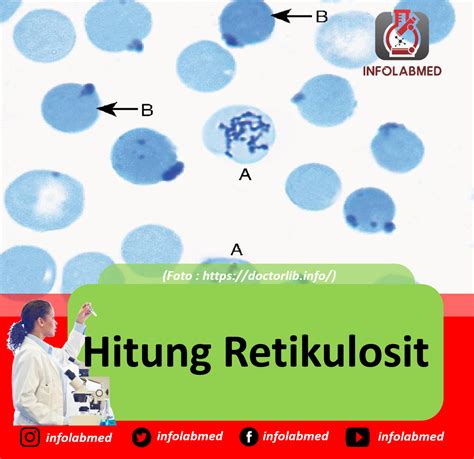 nilai normal retikulosit