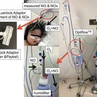 Nitric Oxide Setup