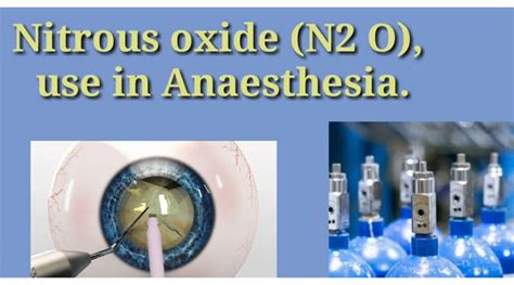 Nitrous Oxide Anesthesia General Uses
