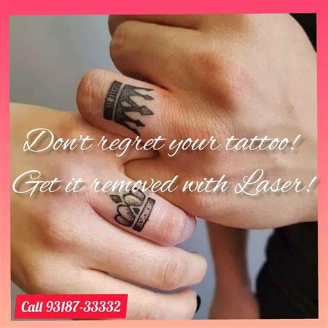 no regrets laser tattoo removal