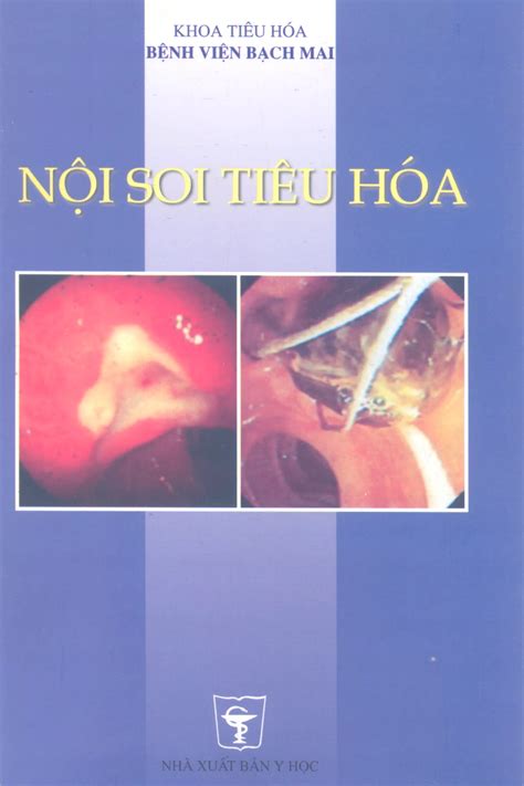 noi soi tieu hoa