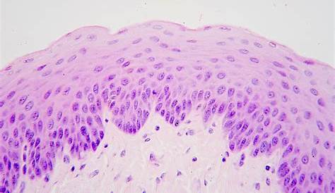 Non Keratinized Stratified Squamous Epithelium Histology Under