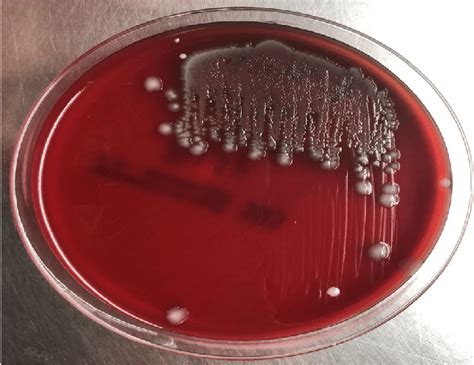 non hemolytic colonies on blood agar