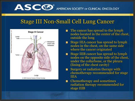 non small cell lung cancer stage 3