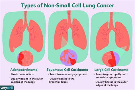 non small cell lung cancer vs adenocarcinoma