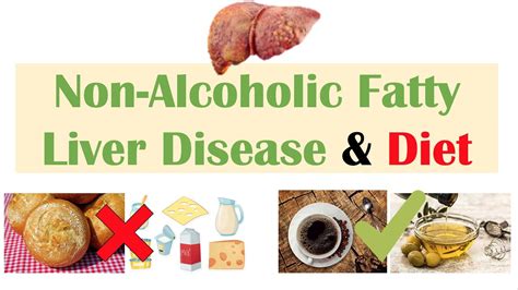 non-alcoholic fatty liver disease diet plan