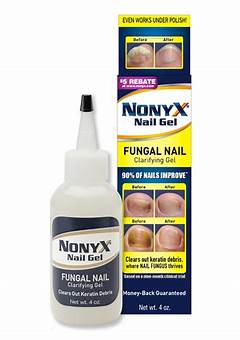 Nonyx Nail Gel: The Ultimate Solution For Healthy And Beautiful Nails