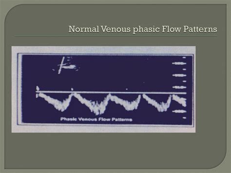 Normal Phasic Flow