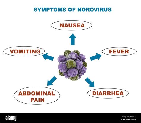 norovirus disease symptoms