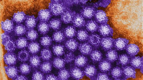 norovirus latest news