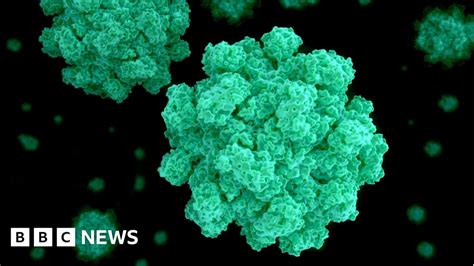 norovirus outbreak probe