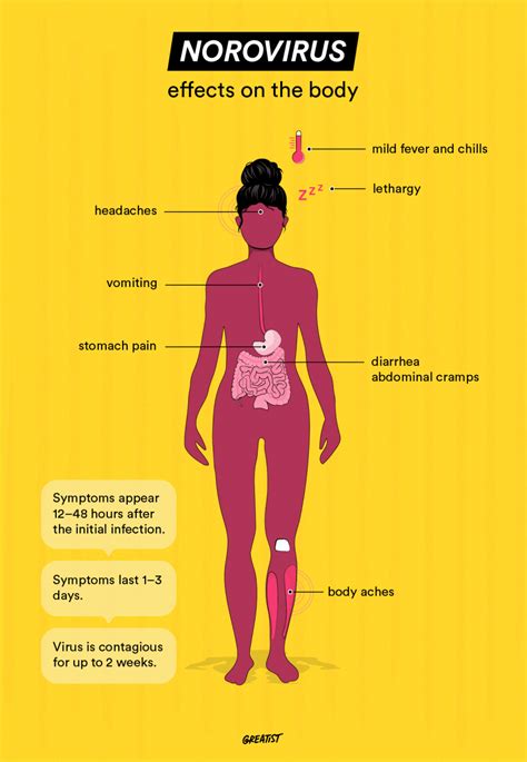 norovirus symptoms and treatment