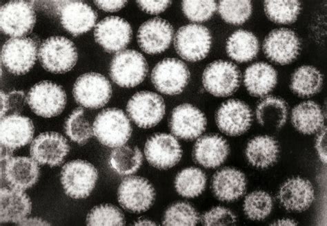 norovirus wikipedia