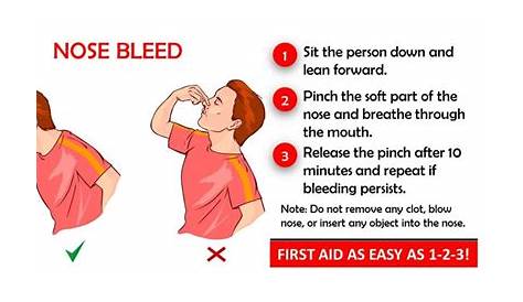 Stop a Nosebleed – a How To Guide for Parents | CHLA