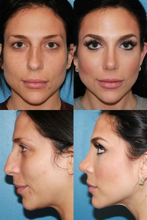 You're So Vain This App Gives You An Instant Nose Job & Perfect Skin