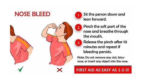 HOW TO STOP NOSEBLEED AT HOME | HealthGist.Net