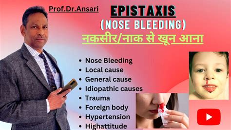 Nose Bleeding and Hypertension: A Potentially Deadly Connection