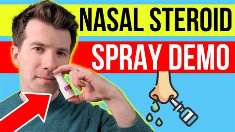 Effective Relief: The Benefits of Nose Spray Steroid Treatment