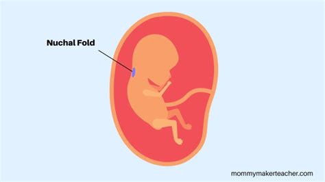 Understanding Nuchal Fold Translucency for Healthier Pregnancy Outcomes